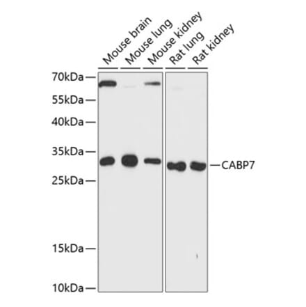 Western Blot - Anti-Calcium binding protein 7 Antibody (A89152) - Antibodies.com