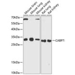 Western Blot - Anti-Calcium binding protein 7 Antibody (A89152) - Antibodies.com