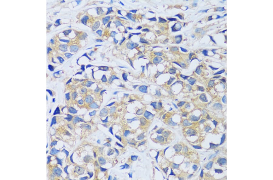 Immunohistochemistry - Anti-Calcium binding protein 7 Antibody (A89152) - Antibodies.com