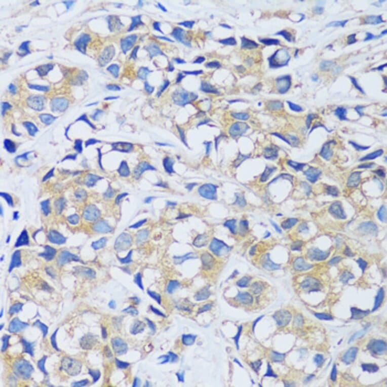Immunohistochemistry - Anti-Calcium binding protein 7 Antibody (A89152) - Antibodies.com