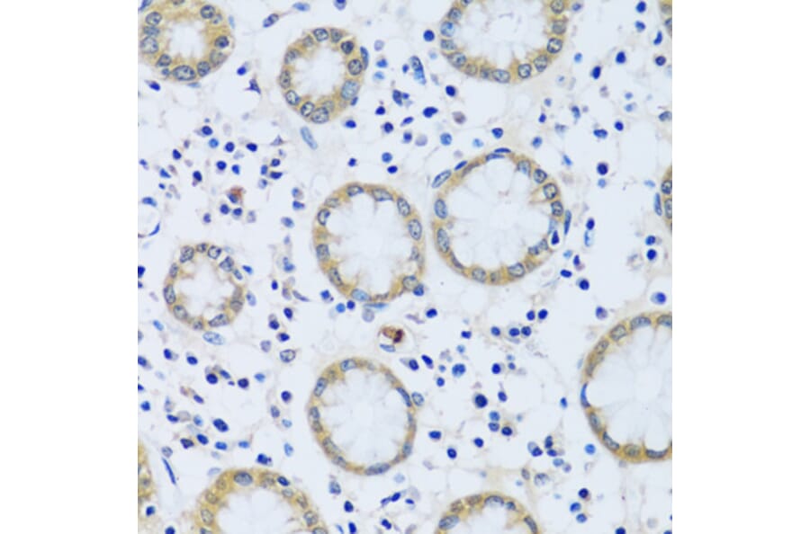 Immunohistochemistry - Anti-Calcium binding protein 7 Antibody (A89152) - Antibodies.com