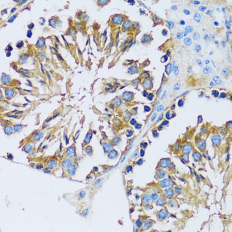 Immunohistochemistry - Anti-Calcium binding protein 7 Antibody (A89152) - Antibodies.com