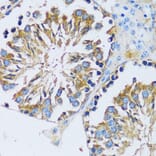 Immunohistochemistry - Anti-Calcium binding protein 7 Antibody (A89152) - Antibodies.com