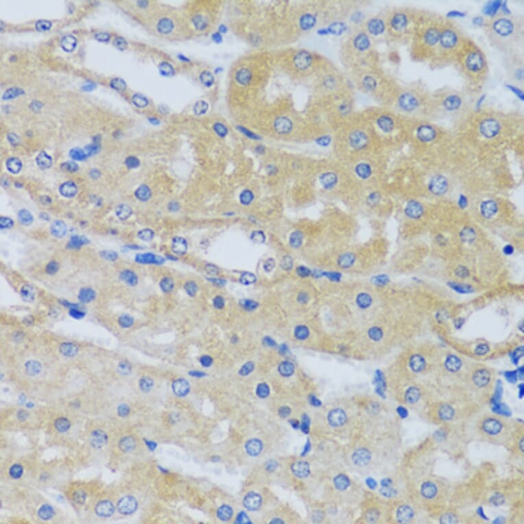 Immunohistochemistry - Anti-Calcium binding protein 7 Antibody (A89152) - Antibodies.com