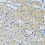 Immunohistochemistry - Anti-Calcium binding protein 7 Antibody (A89152) - Antibodies.com