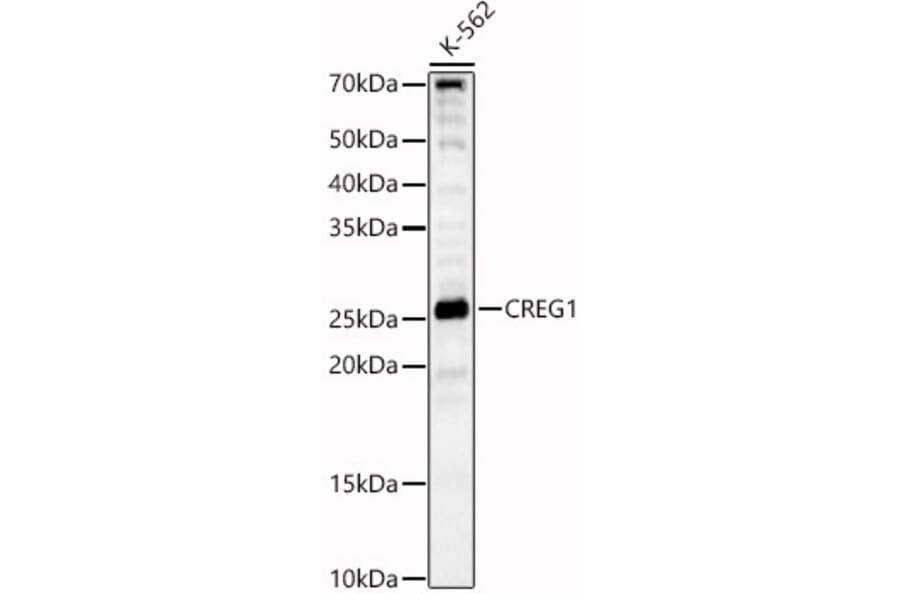 Western Blot - Anti-CREG1/CREG Antibody (A89153) - Antibodies.com