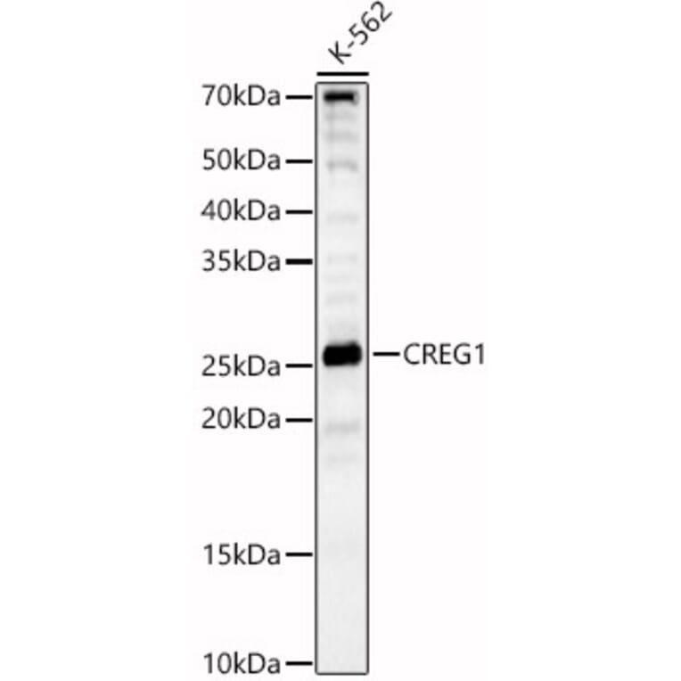 Western Blot - Anti-CREG1/CREG Antibody (A89153) - Antibodies.com