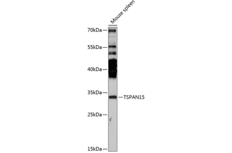 Western Blot - Anti-TSPAN15 Antibody (A89154) - Antibodies.com