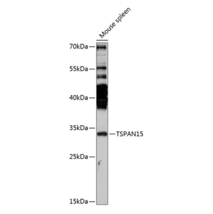 Western Blot - Anti-TSPAN15 Antibody (A89154) - Antibodies.com