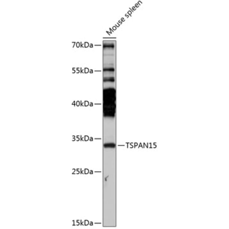 Western Blot - Anti-TSPAN15 Antibody (A89154) - Antibodies.com