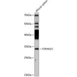 Western Blot - Anti-TSPAN15 Antibody (A89154) - Antibodies.com