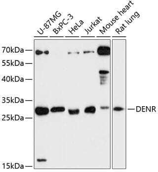 Western blot analysis of extracts of various cell lines, using Anti-DENR Antibody (A13699) at 1:3000 dilution.
Secondary antibody: Goat Anti-Rabbit IgG (H+L) (HRP) (AS014) at 1:10,000 dilution.
Lysates / proteins: 25µg per lane.
Blocking buffer: 3% non-fat dry milk in TBST.
Detection: ECL Enhanced Kit (RM00021).
Exposure time: 90s.
