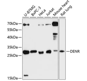 Western Blot - Anti-Density Regulated Protein Antibody (A89155) - Antibodies.com