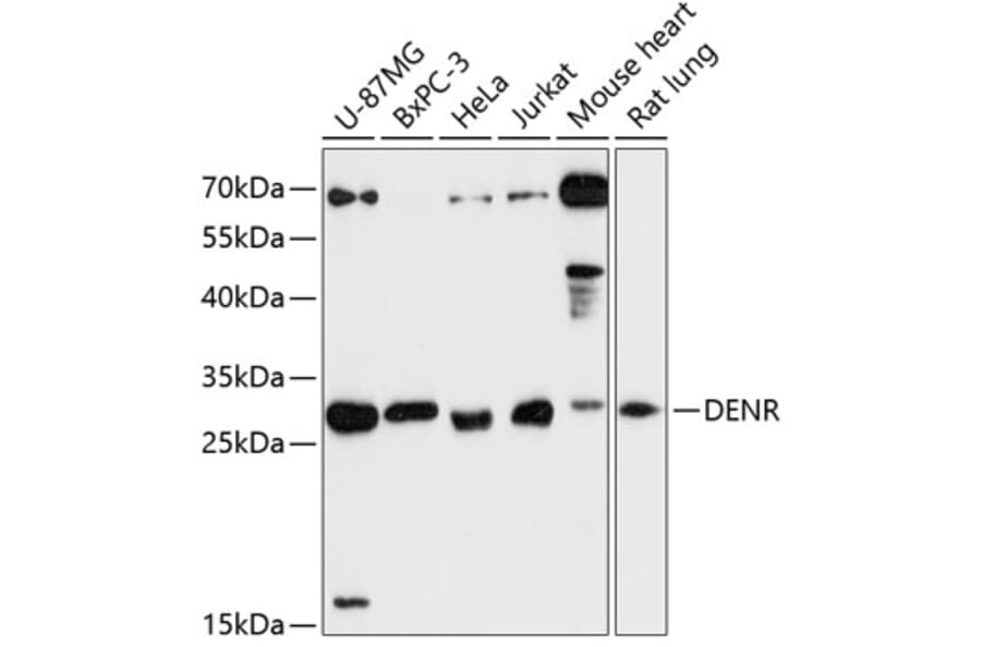 Western Blot - Anti-Density Regulated Protein Antibody (A89155) - Antibodies.com