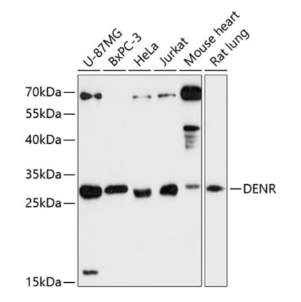 Western Blot - Anti-Density Regulated Protein Antibody (A89155) - Antibodies.com