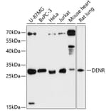 Western Blot - Anti-Density Regulated Protein Antibody (A89155) - Antibodies.com
