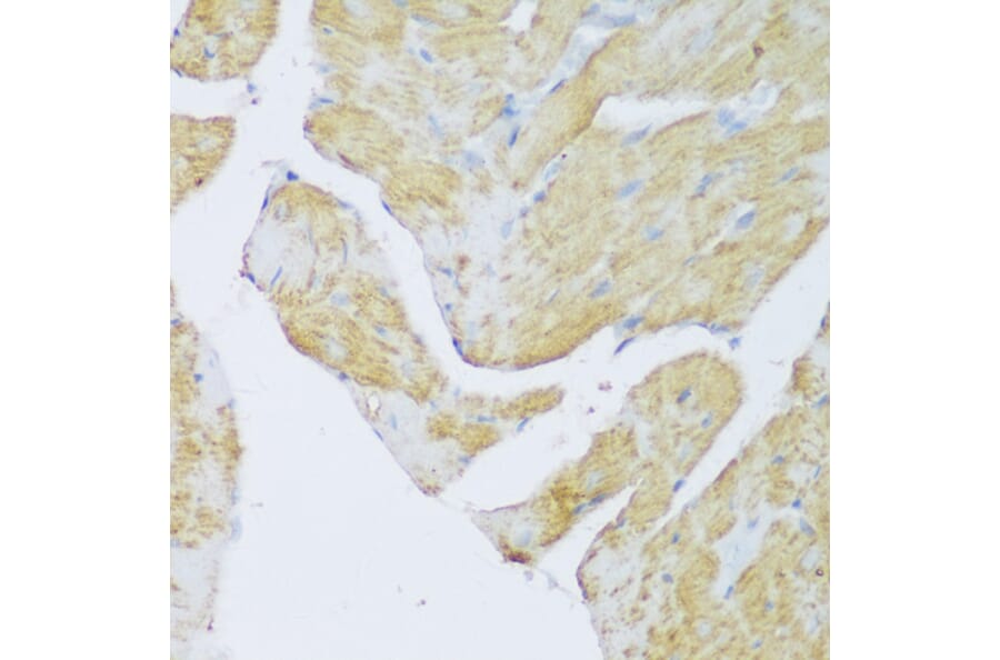 Immunohistochemistry - Anti-Density Regulated Protein Antibody (A89155) - Antibodies.com