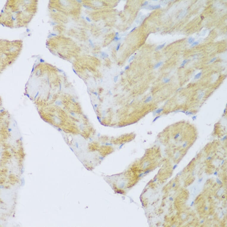 Immunohistochemistry - Anti-Density Regulated Protein Antibody (A89155) - Antibodies.com
