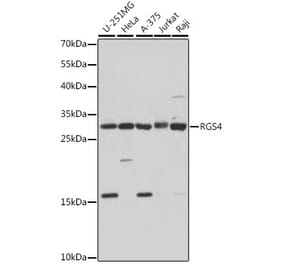 Western Blot - Anti-RGS4 Antibody (A89156) - Antibodies.com
