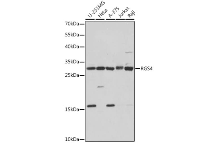 Western Blot - Anti-RGS4 Antibody (A89156) - Antibodies.com