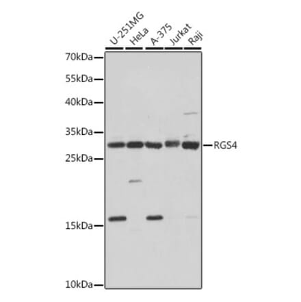 Western Blot - Anti-RGS4 Antibody (A89156) - Antibodies.com