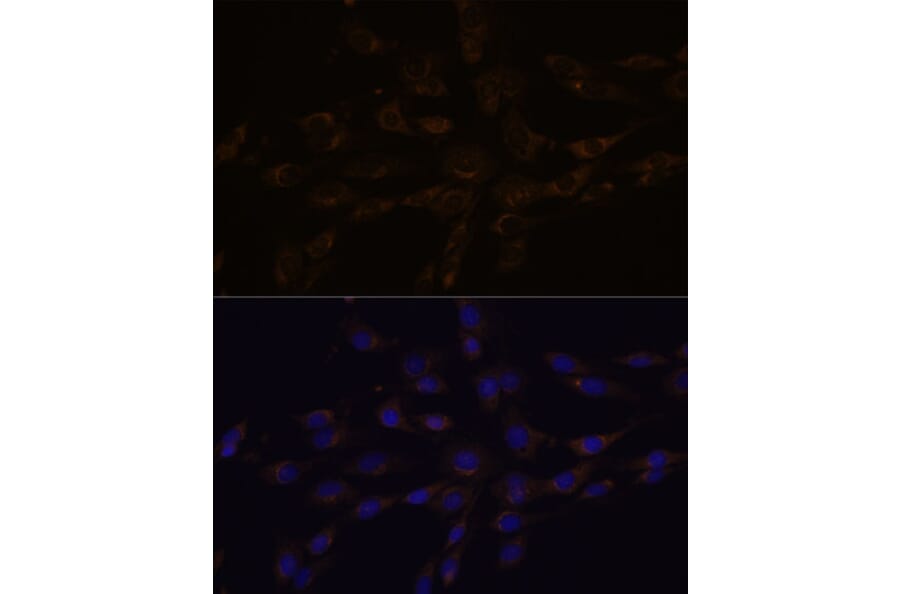 Immunofluorescence - Anti-RGS4 Antibody (A89156) - Antibodies.com