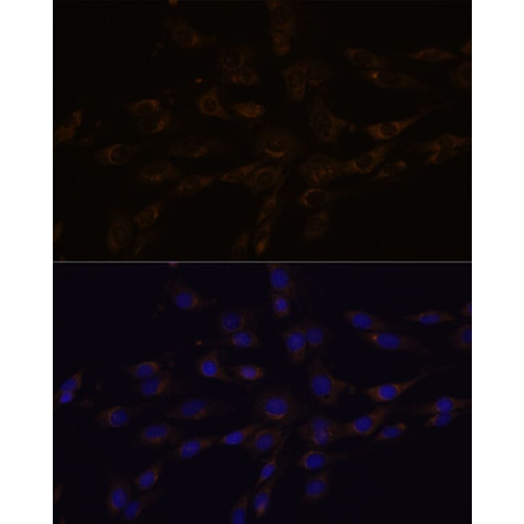 Immunofluorescence - Anti-RGS4 Antibody (A89156) - Antibodies.com