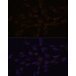 Immunofluorescence - Anti-RGS4 Antibody (A89156) - Antibodies.com