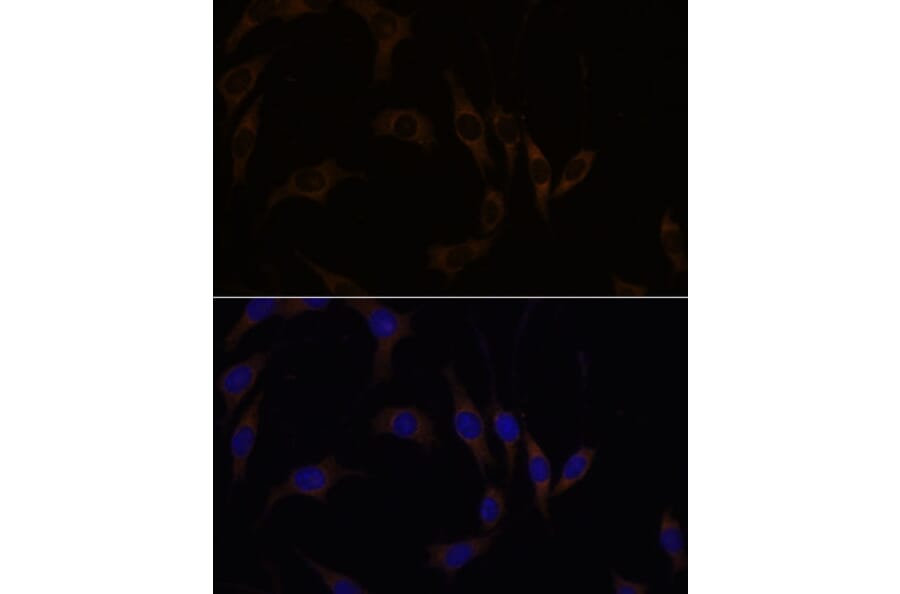 Immunofluorescence - Anti-RGS4 Antibody (A89156) - Antibodies.com