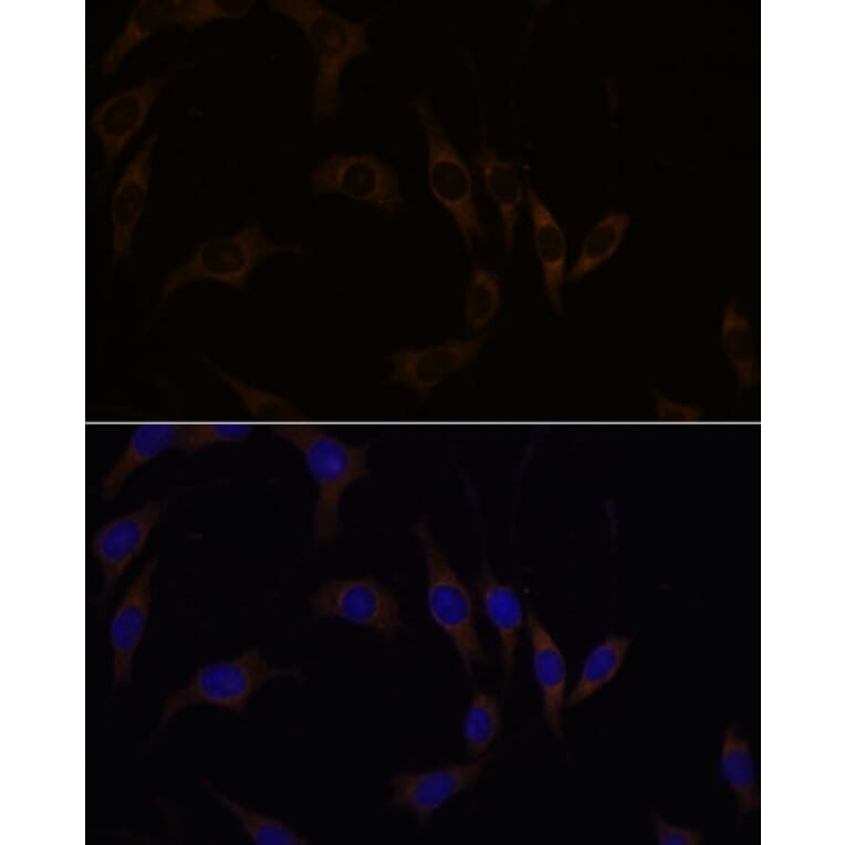 Immunofluorescence - Anti-RGS4 Antibody (A89156) - Antibodies.com