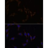 Immunofluorescence - Anti-RGS4 Antibody (A89156) - Antibodies.com