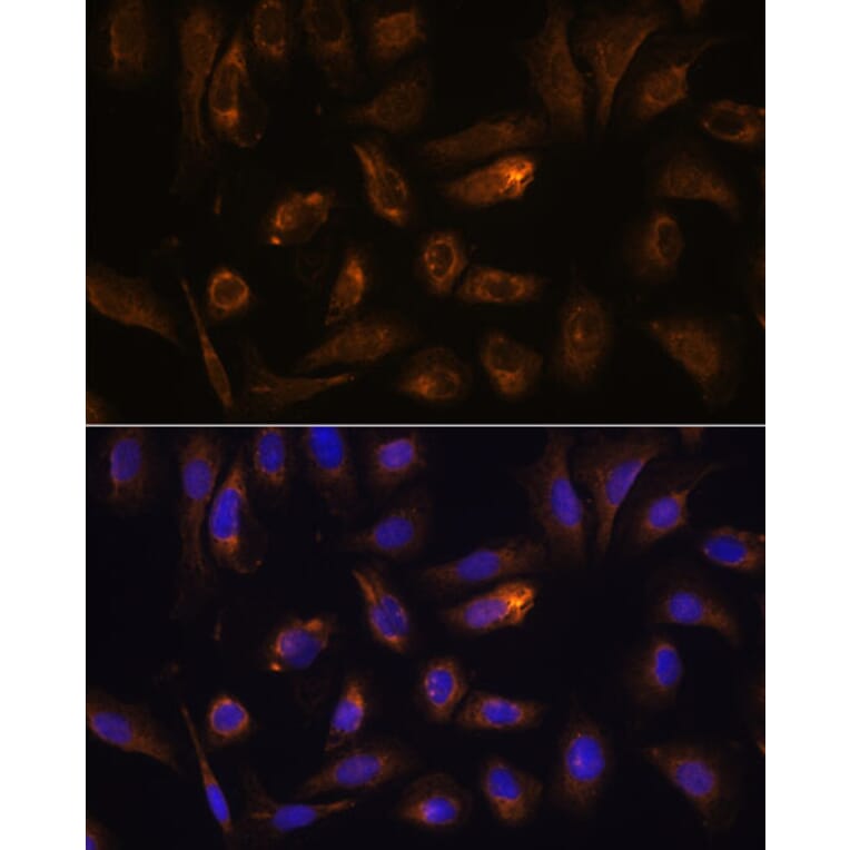 Immunofluorescence - Anti-RGS4 Antibody (A89156) - Antibodies.com