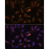 Immunofluorescence - Anti-RGS4 Antibody (A89156) - Antibodies.com