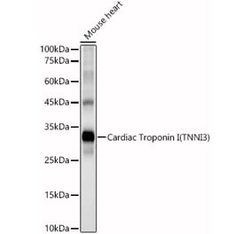 Western Blot - Anti-Cardiac Troponin I Antibody (A89157) - Antibodies.com