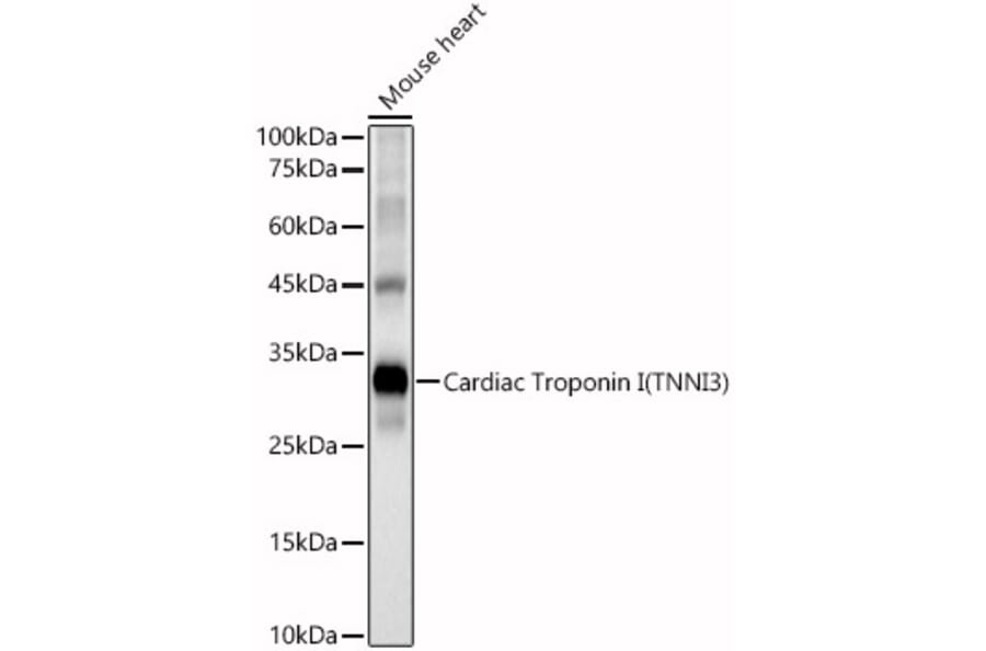 Western Blot - Anti-Cardiac Troponin I Antibody (A89157) - Antibodies.com