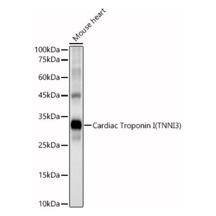 Western Blot - Anti-Cardiac Troponin I Antibody (A89157) - Antibodies.com