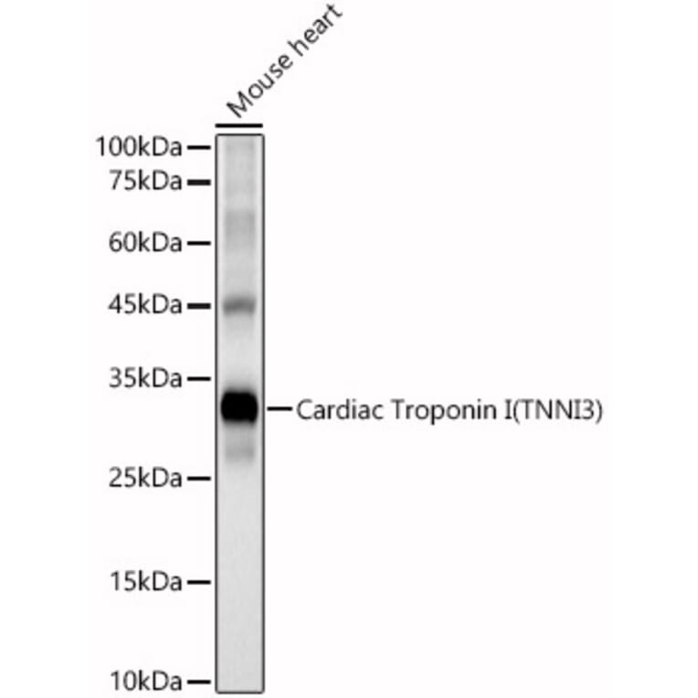 Western Blot - Anti-Cardiac Troponin I Antibody (A89157) - Antibodies.com