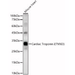 Western Blot - Anti-Cardiac Troponin I Antibody (A89157) - Antibodies.com