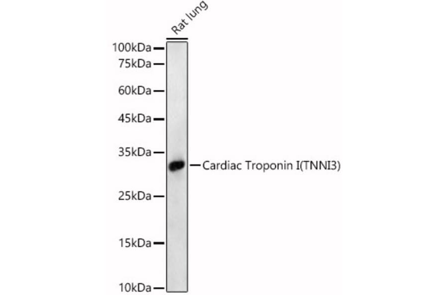 Western Blot - Anti-Cardiac Troponin I Antibody (A89157) - Antibodies.com