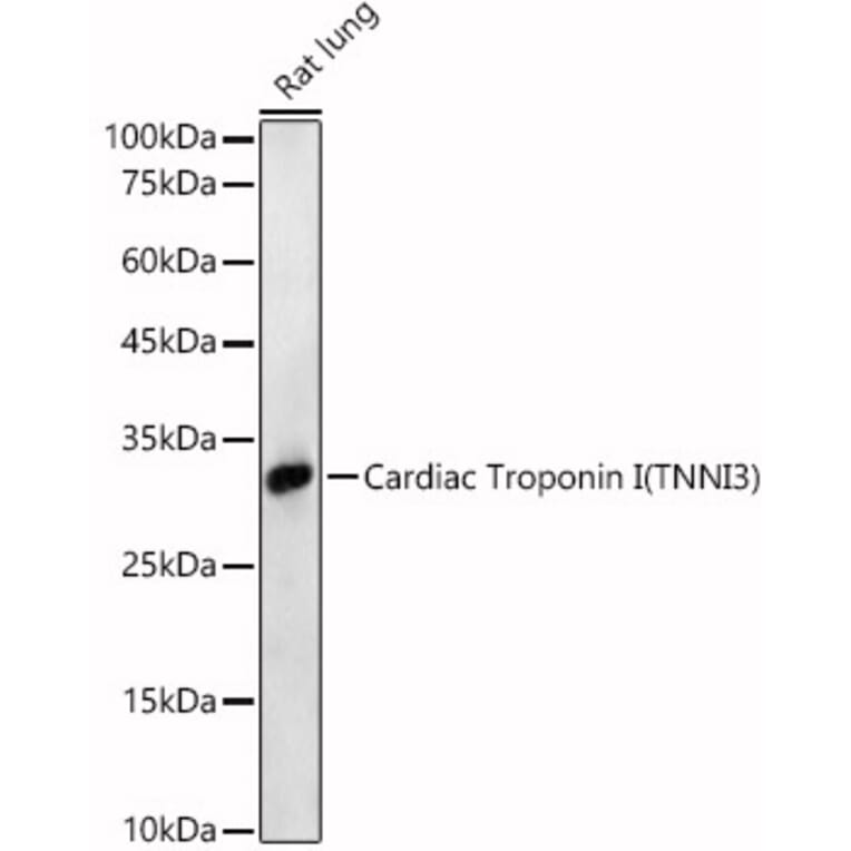 Western Blot - Anti-Cardiac Troponin I Antibody (A89157) - Antibodies.com