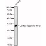 Western Blot - Anti-Cardiac Troponin I Antibody (A89157) - Antibodies.com
