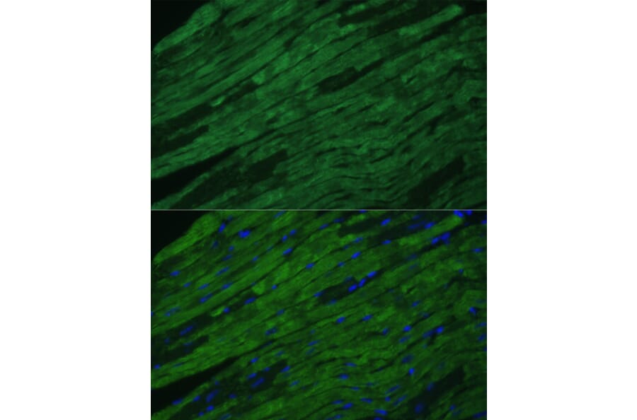 Immunofluorescence - Anti-Cardiac Troponin I Antibody (A89157) - Antibodies.com