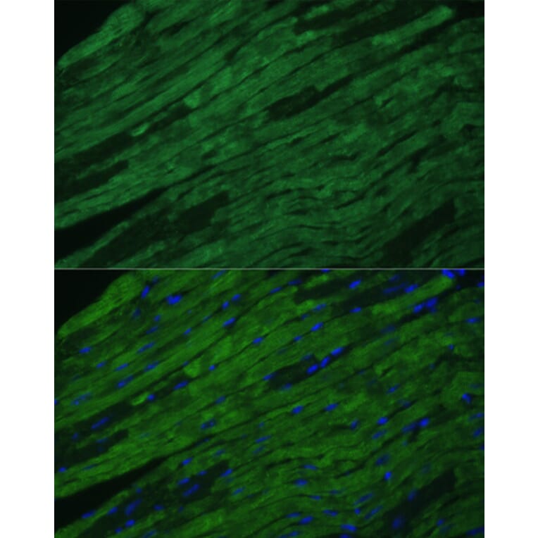 Immunofluorescence - Anti-Cardiac Troponin I Antibody (A89157) - Antibodies.com