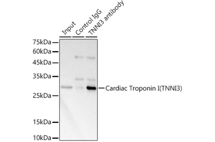 Western Blot - Anti-Cardiac Troponin I Antibody (A89157) - Antibodies.com