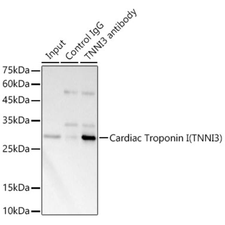 Western Blot - Anti-Cardiac Troponin I Antibody (A89157) - Antibodies.com
