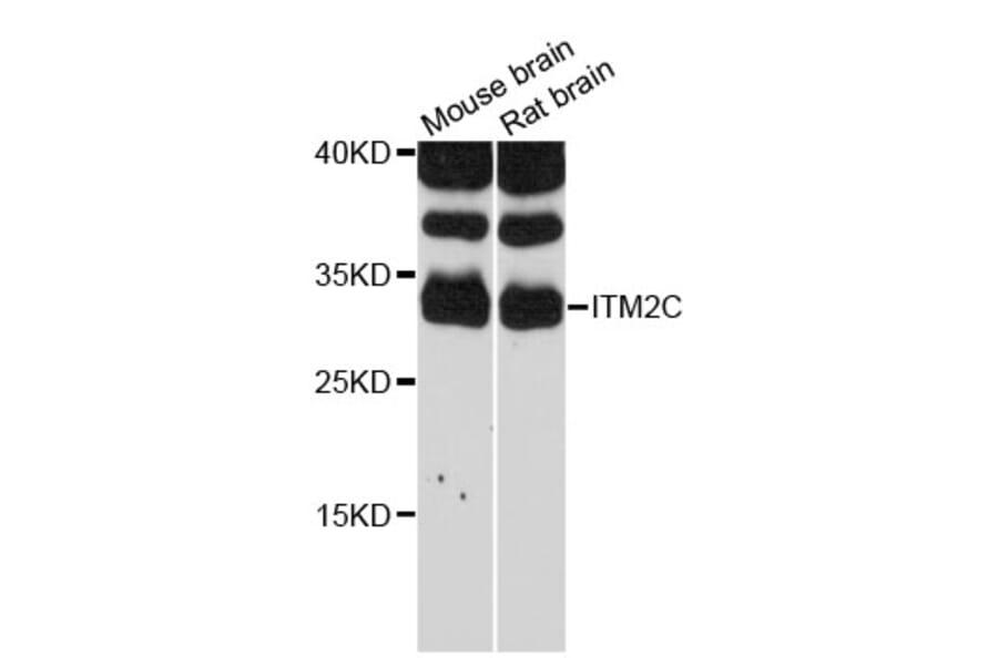 Western Blot - Anti-ITM2C Antibody (A12675) - Antibodies.com