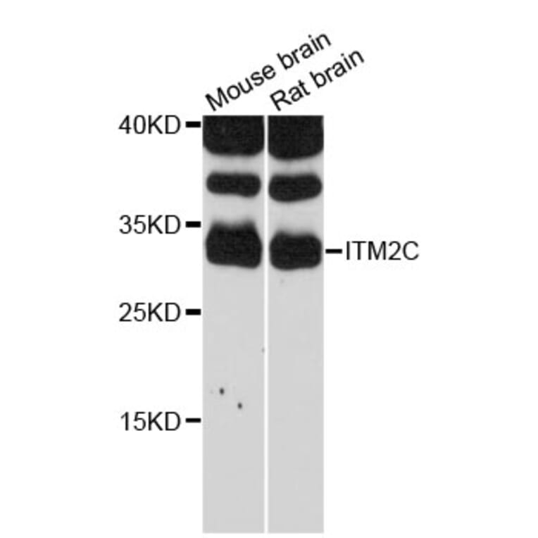Western Blot - Anti-ITM2C Antibody (A12675) - Antibodies.com
