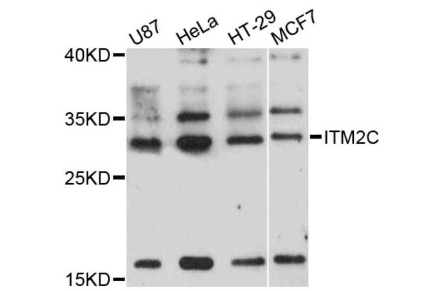 Western Blot - Anti-ITM2C Antibody (A8915) - Antibodies.com