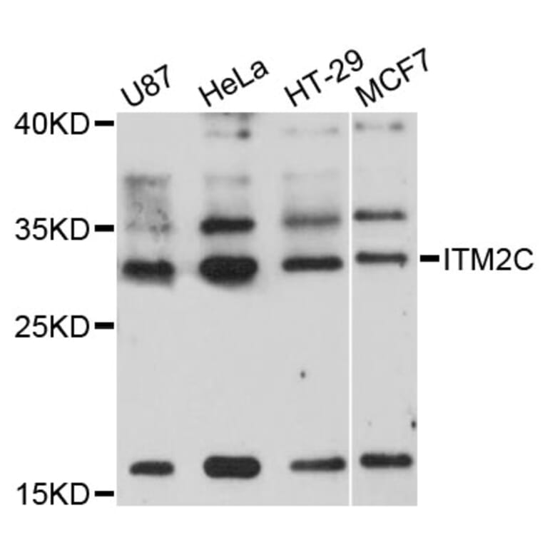 Western Blot - Anti-ITM2C Antibody (A8915) - Antibodies.com