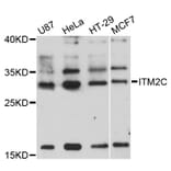 Western Blot - Anti-ITM2C Antibody (A8915) - Antibodies.com